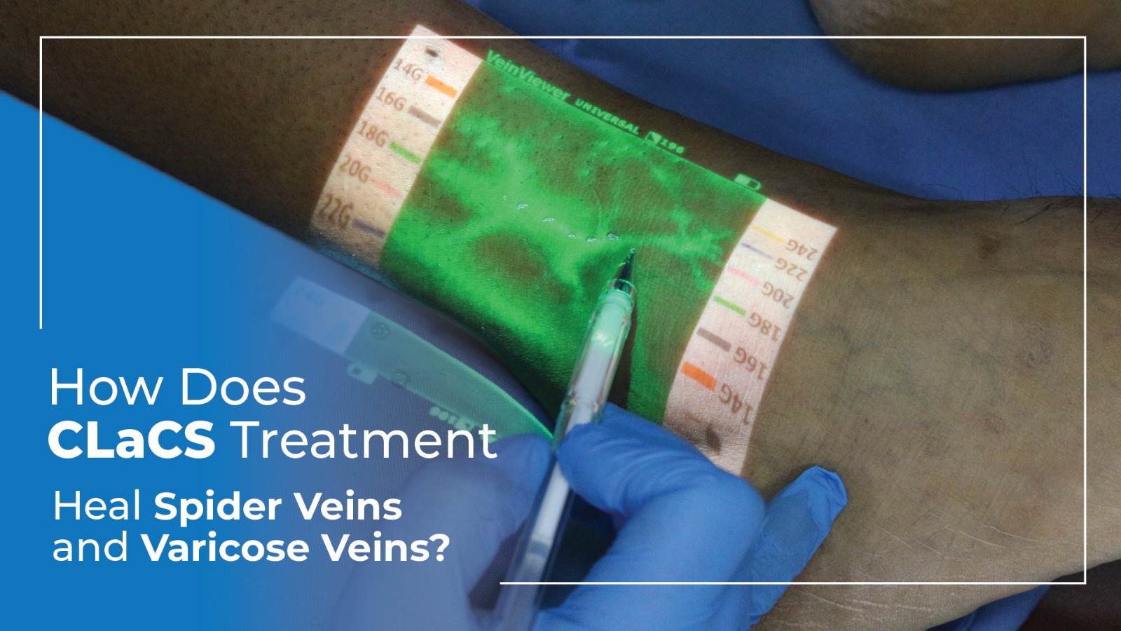 transforming-lives-patients-journey-venous-problems-avis-vascular-center